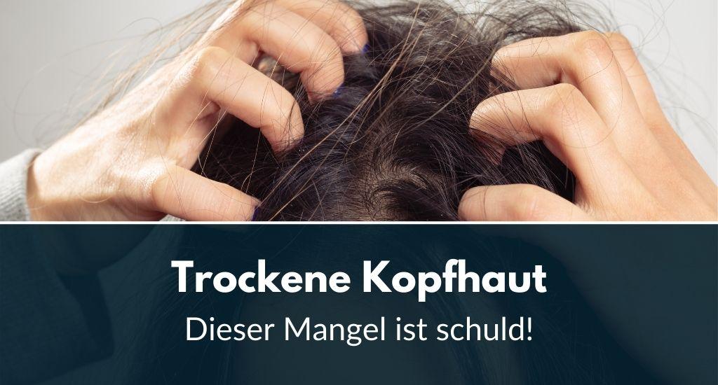Trockene Kopfhaut: Dieser Mangel ist schuld!