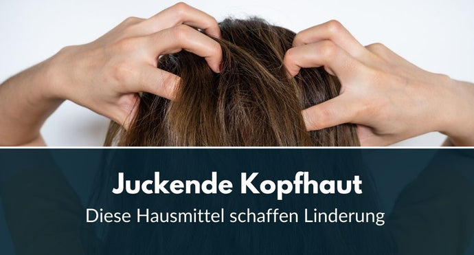 Juckende Kopfhaut: Diese Hausmittel schaffen Linderung